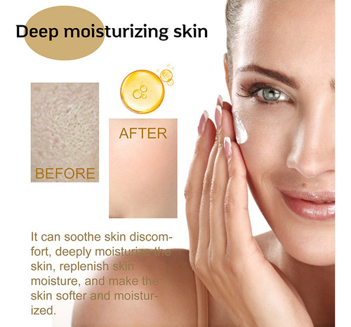 O Sérum Facial Coreano Centella Asiatica Nutre A Pele Seca