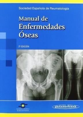 Manual De Enfermedades Oseas (2 Edicion) (rustico) - Socied