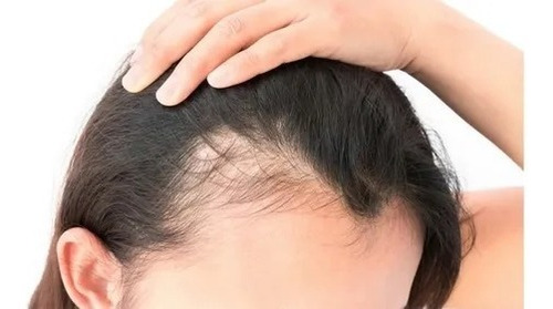 Imagen 6 de 8 de Bioactivador Capilar Con Redensyl - 100ml - Laca