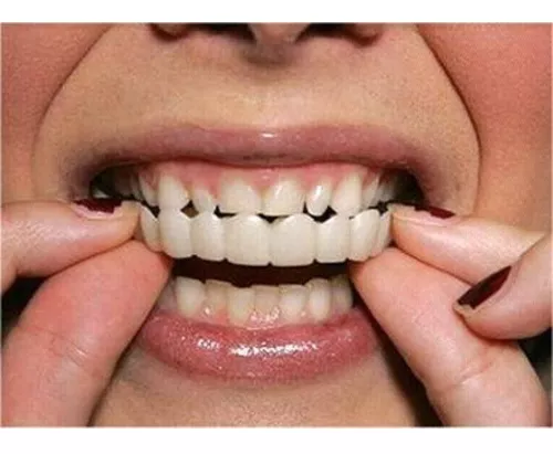 Dientes Postizos Temporales Carillas Dentales Ajustables Para