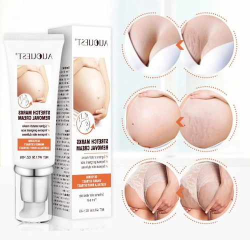 Creme Anti Estrias Stretch Marks Removal