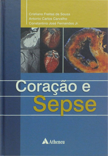 Coração e Sepse, de Carvalho, Antônio Carlos de Camargo. Editora Atheneu Ltda, capa mole em português, 2010