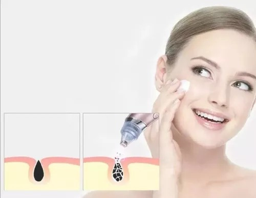Limpiador Facial Extractor