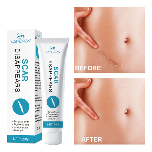 Gel Eliminador De Cicatrices Go For Queloides, Crema Repara