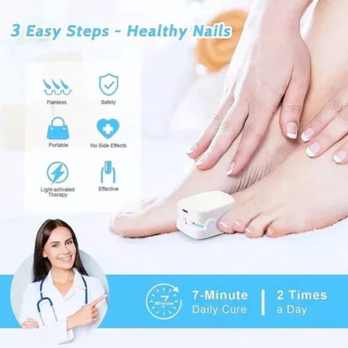 Láser Para Eliminar Hongos En Las Uñas Onicomicosis Uña