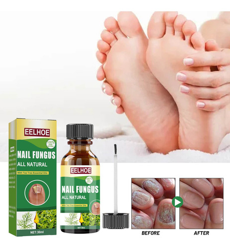 - Solución Contaminante Para El Cuidado De Las Uñas, 30 Ml