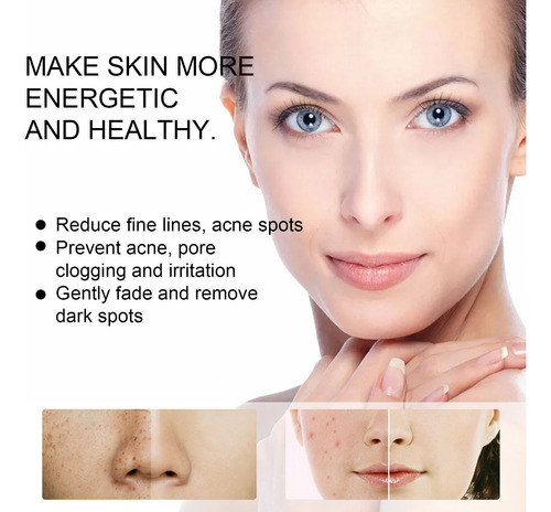 Crema Antipecas G Hidratante Antiarrugas Y Rejuvenecedora C