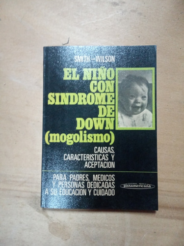 El Niño Con Síndrome De Down. Smith-wilson (1986/128 Pág.).