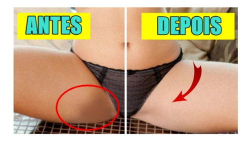 Pomada Micosan Pano Branco Para Micoses Em Geral 50g