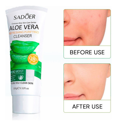 Jabón Facial Aloe Vera Al 98% - g a $110