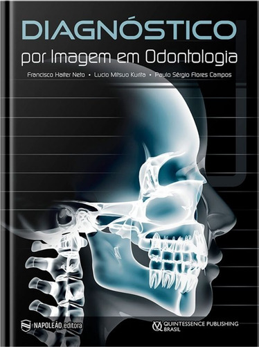 Diagnóstico Por Imagem Em Odontologia - Haiter Neto