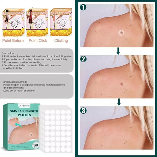 Imagen 2 de 3 de Parches Para Eliminar Verrugas, Granos, Acné Y Otras