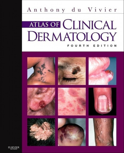 Libro Atlas Of Clinical Dermatology