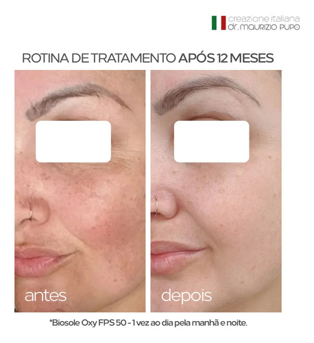 Protetor Solar 12hs Clareador Com Vitamina C E Niacinamida Biosole Oxy Fps 50