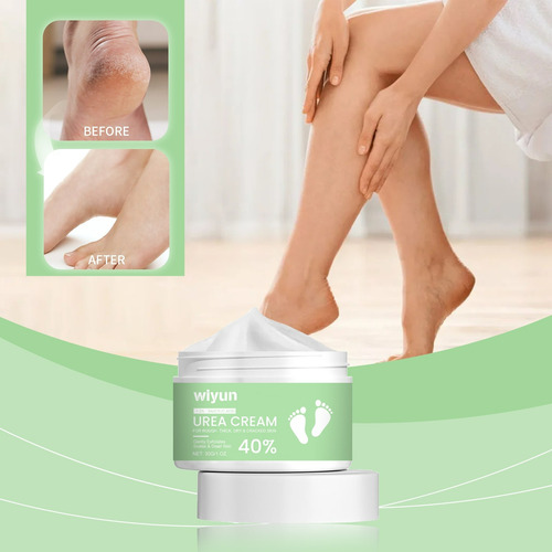 N The Urea Nourishes The Foot Cream To Exfoliate The Cu 1004