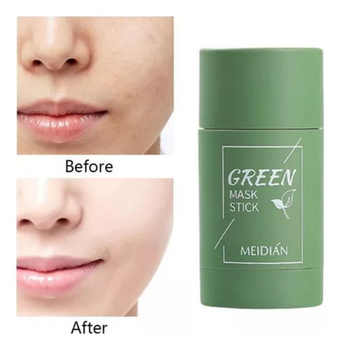3 Pcs Blackhead And Pimple Remover Green Mask Stick
