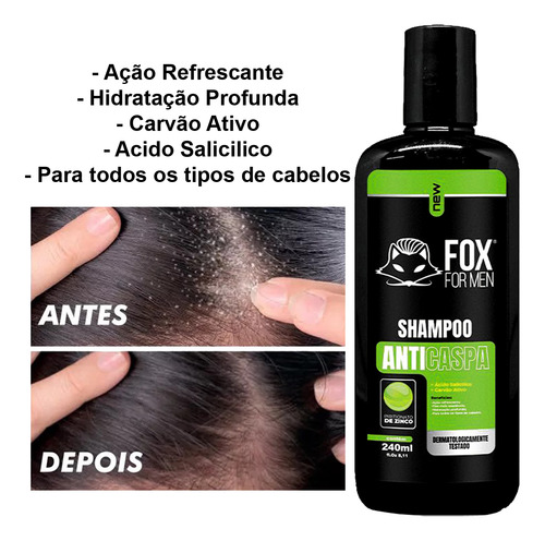 Shampoo Anticaspa Refrescante Limpeza Profunda Xampu Shampu