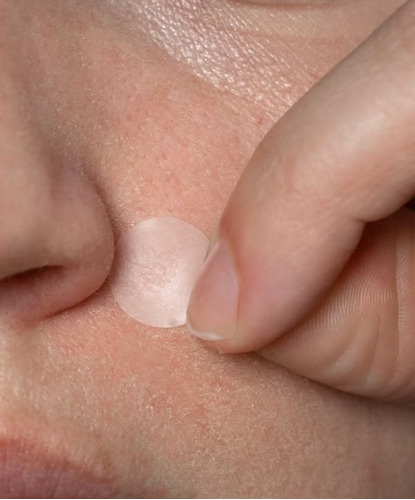 Neutrogena Parches De Espinilla Calcomanías De Hidrocoloides Momento De Aplicación Día/noche Tipo De Piel Todo Tipo De Piel Todo Tipo De Piel