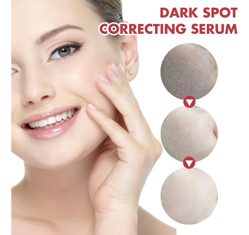 Suero Corrector De Manchas Oscuras Con Niacinamida