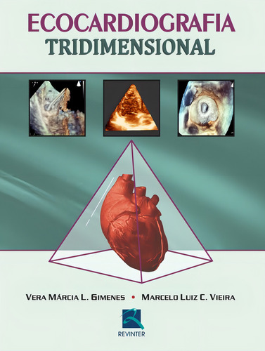 Ecocardiografia Tridimensional, de Gimenes, Vera Márcia L.. Editorial Thieme Revinter Publicações Ltda, capa dura em português, 2015