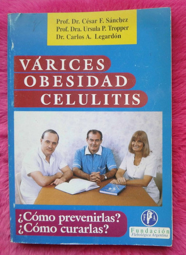 Varices Obesidad Celulitis - Prevencion Curacion 