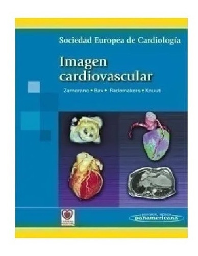 Imagen Cardiovascular !