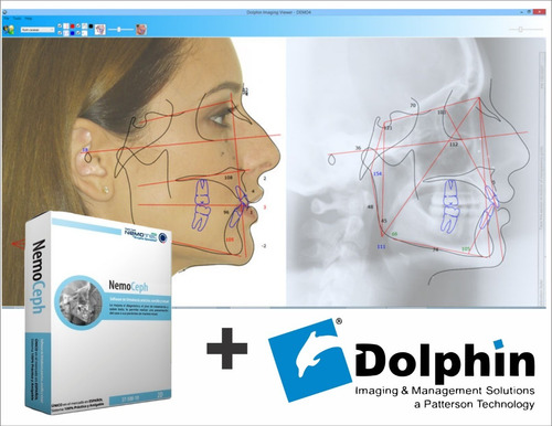 dolphin imaging & management solutions dolphin imaging & management solutions