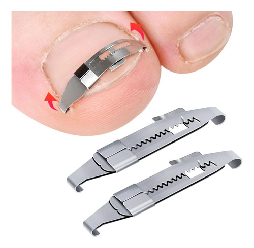 2 Uds Herramientas De Corrección De Uñas Encarnadas Clips