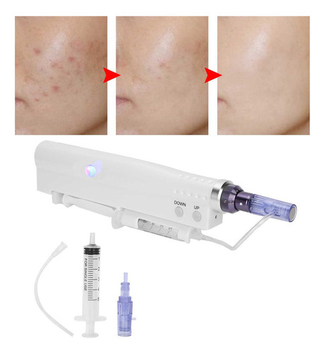 Eelctric Microneedle Machine Mts Eliminación De Acné Hialuró