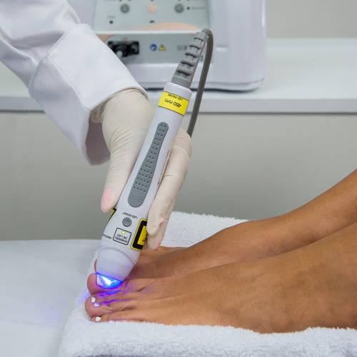 Caneta Probe Mini Led Azul 450nm P/ Dermosteam V3.0 Ibramed