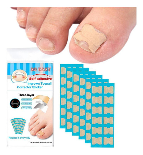 Tratamiento De Uñas De Los Pies Para Uñas Negras 72 Hojas