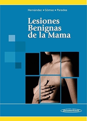 Lesiones Benignas De La Mama / Benign Breast Lesions&-.