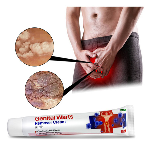 Verrugas Genitais Hpv Condilomas Pomada Creme P/ Eliminação Neutra