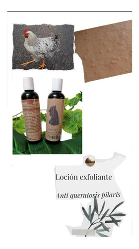 Loción Exfoliante Para Queratosis Pilaris/piel De Gallina