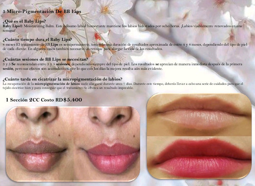 Tienes Labios Negros O Palidos Bb Lips Micro-pigmentación