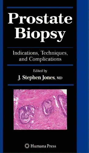 Prostate Biopsy, De J. Stephen Jones. Editorial Humana Press Inc, Tapa Dura En Inglés