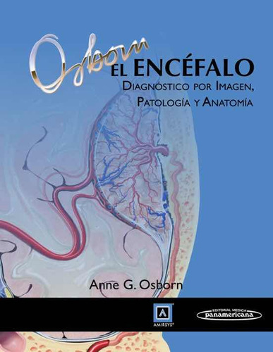 Encefalo: Diagnóstico Por Imagen, Patología Y Anatomía