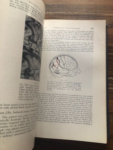 Wilder Penfield. Epilepsy And The Functional Anatomy Of The (Usado)
