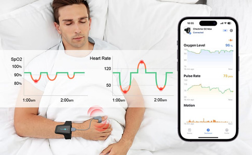 Medidor De Oxígeno Bluetooth Para La Salud,monitor De Oxigen