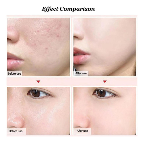 Barra De Poros Invisible - Prebase De Maquillaje Facial Resi