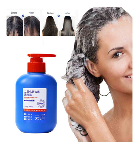 * ! Shampoo Para Remover Bronzeado E Caspa Com Dissulfeto D
