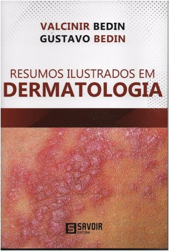 Resumos Ilustrados Em Dermatologia, De Bedin, Valcinir/ Bedin, Gustavo. Editora Editora Savoir Ltda - Me, Edição 1 Em Português