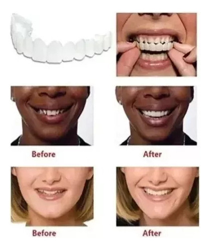 2pcs Carillas Dientes Postizos De Sonrisa Superior Inferior