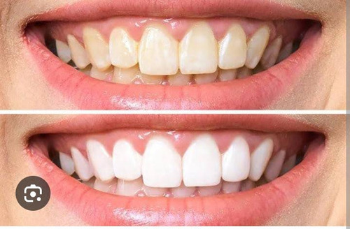 Sorria Como Uma Estrela! Seu Sorriso Merece Brilhar!