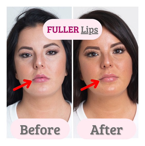 Aparato De Ejercicio Facial Blafit Bella Lip Appliance Laven