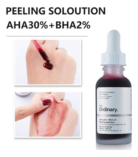 ¿la Solución De Peeling Ordinaria Con Aha 30% Y Bha 2%