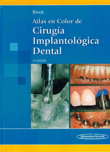 Cirugía Implantológica Dental - Atlas En Color - Block 