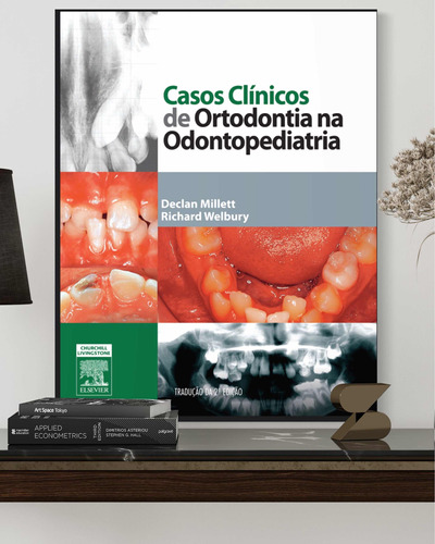 Casos Clinicos De Ortodontia Na Odontopediatria