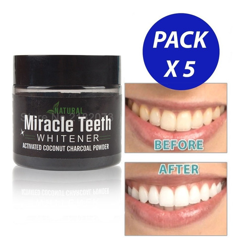 Pack 5 Miracle Teeth, Blanqueador Dental / E-roca