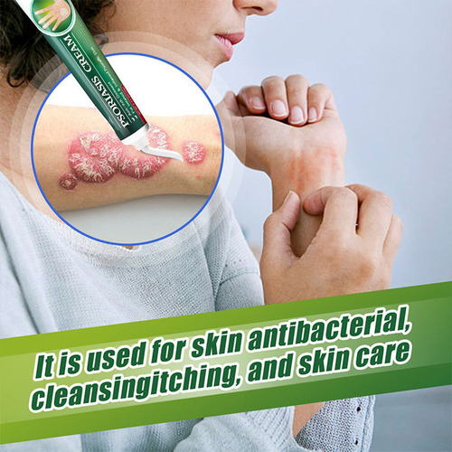 Mz D Crema Dermatofito Psoriasis Crema Dermatofito Tópica